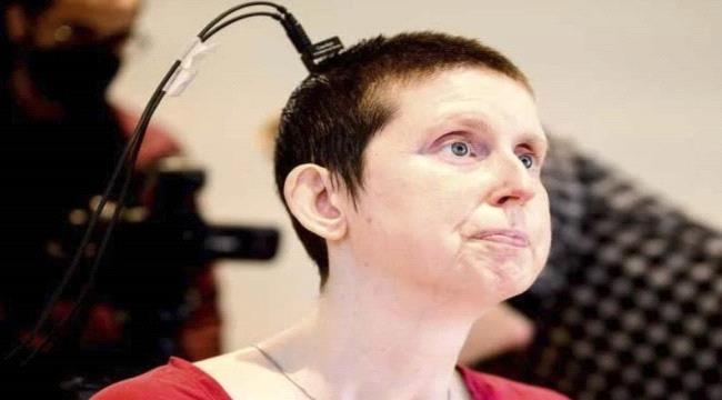 غرسة دماغية تترجم الأفكار إلى كلام مسموع بشكل فوري