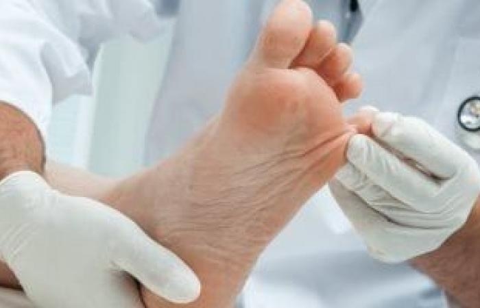 صحة وطب : أسباب "التنميل" فى القدمين.. ومتى يكون علامة خطر