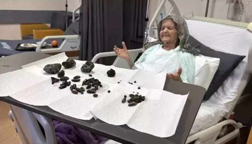 تركيا.. أطباء يعثرون على "أجسام غريبة" في معدة مسنّة