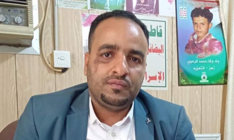مدير كهرباء تعز يتحدى العرادة و"الإخوان" و"عفاش" إعادة التيار