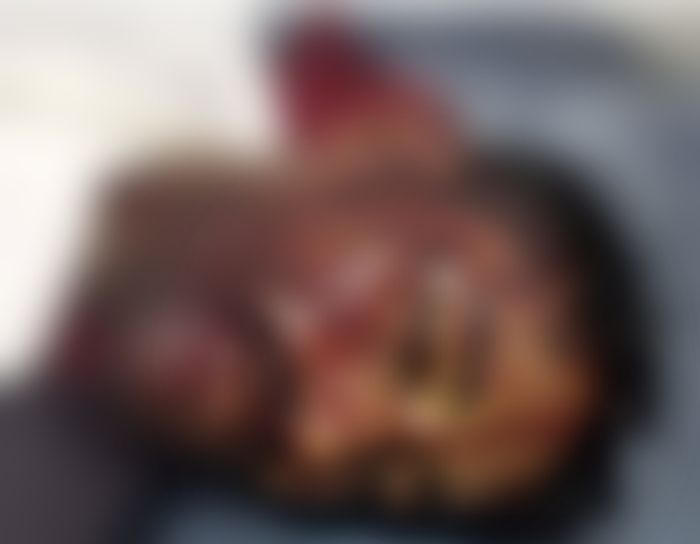 وفاة شخص وإصابة آخر نتيجة حادث مروري على الخط الرابط بين الخوخة والمخا