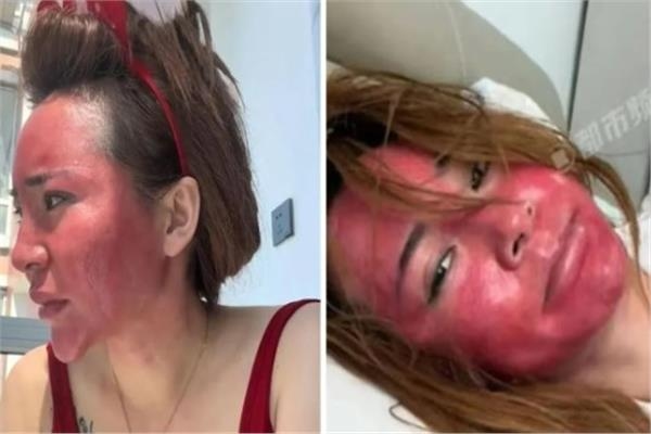 22 عاما بلا إزالة مكياج.. صينية تدفع ثمن الإهمال بوجه مشوه وحالة نفسية