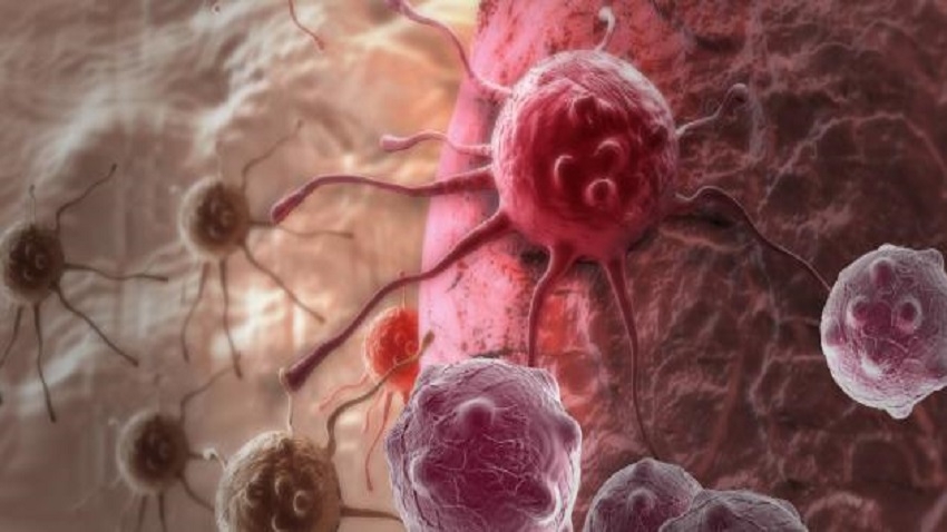 بروتوكول جديد يشفي سرطان الثدي الوراثي بنسبة 100% : دراسة بريطانية تُبشر بنهاية معاناة BRCA