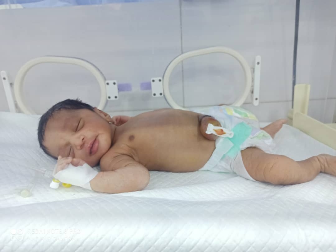 فاعل خير يتكفل بإجراء عملية جراحية للطفل 'محمد التويم' بأبين