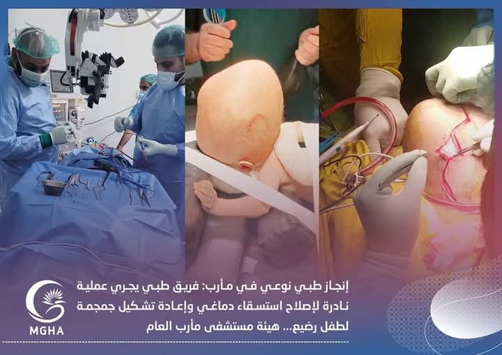 إنجاز طبي لهيئة مستشفى مأرب: فريق طبي يجري عملية نادرة لإصلاح استسقاء دماغي وإعادة تشكيل جمجمة لطفل رضيع.