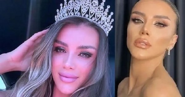 مصرع ملكة جمال دهسًا بعد فرارها من الشرطة