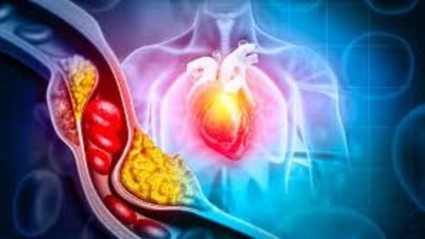 الكوليسترول الخفي: مأكولات غير متوقعة تقف وراء ارتفاعه
