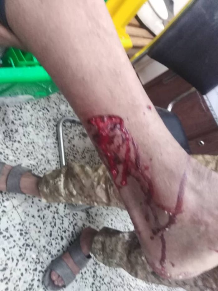 الكلاب الضالة كابوس مرعب لابناء رداع والحوثي يتنصل عن توفير اللقاحات