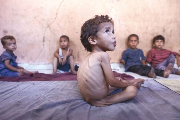 منظمة الصحة العالمية: ((جزء كبير)) من سكان غزة يتضوّرون جوعاً