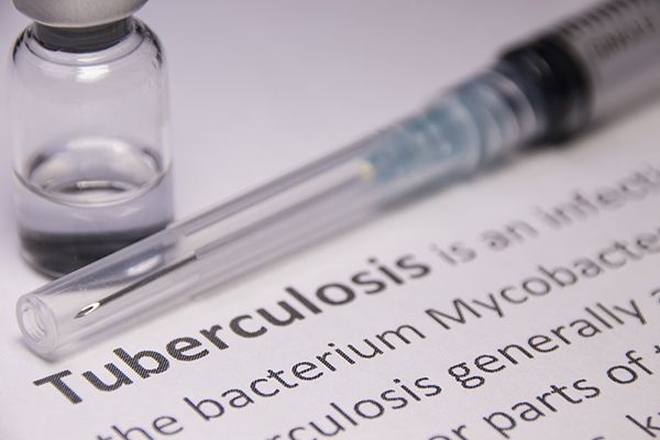 Selangor to carry on TB treatment incentive