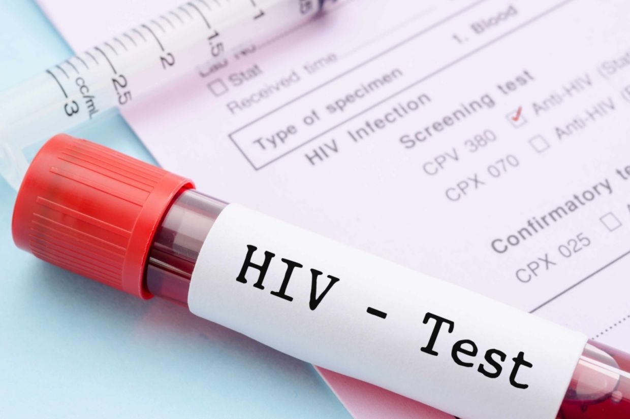 Mulling a more holistic approach to curb HIV rise among youth