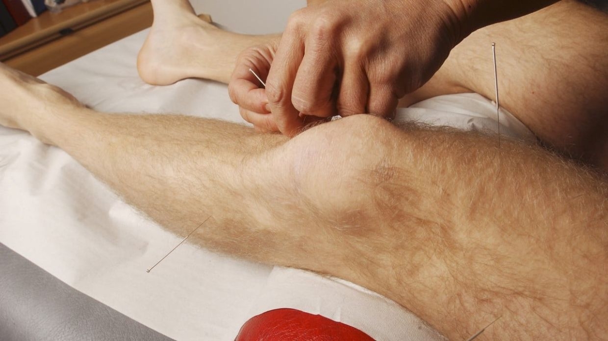 Hongkongers urged not to slam acupuncture treatment after ‘flesh-eating' infection