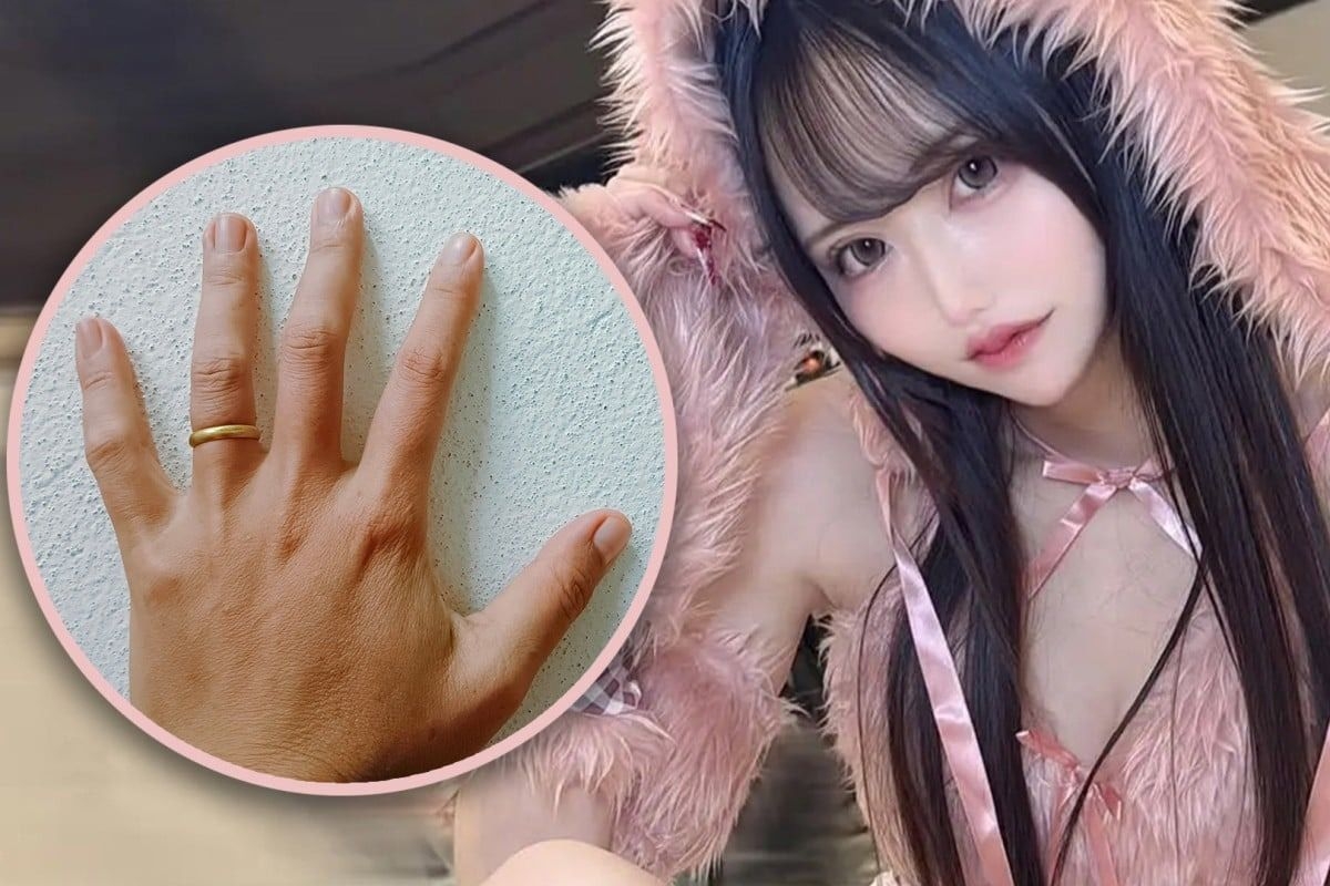 Japanese woman cuts off boyfriend's ring finger to prevent him from marrying someone else