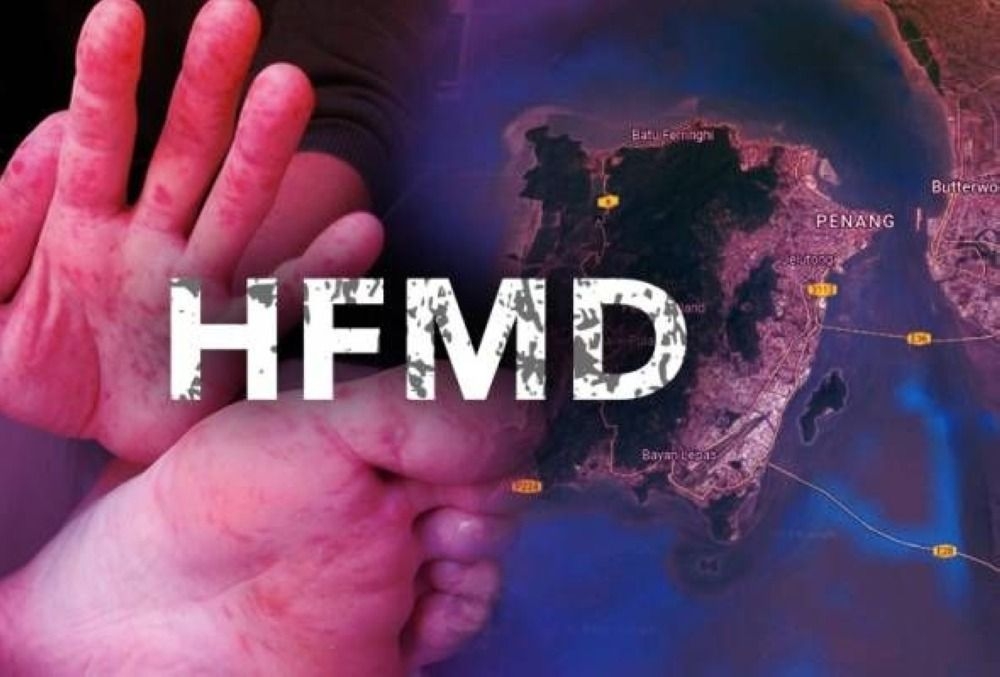 Selangor strengthens measures to curb rise in HFMD cases