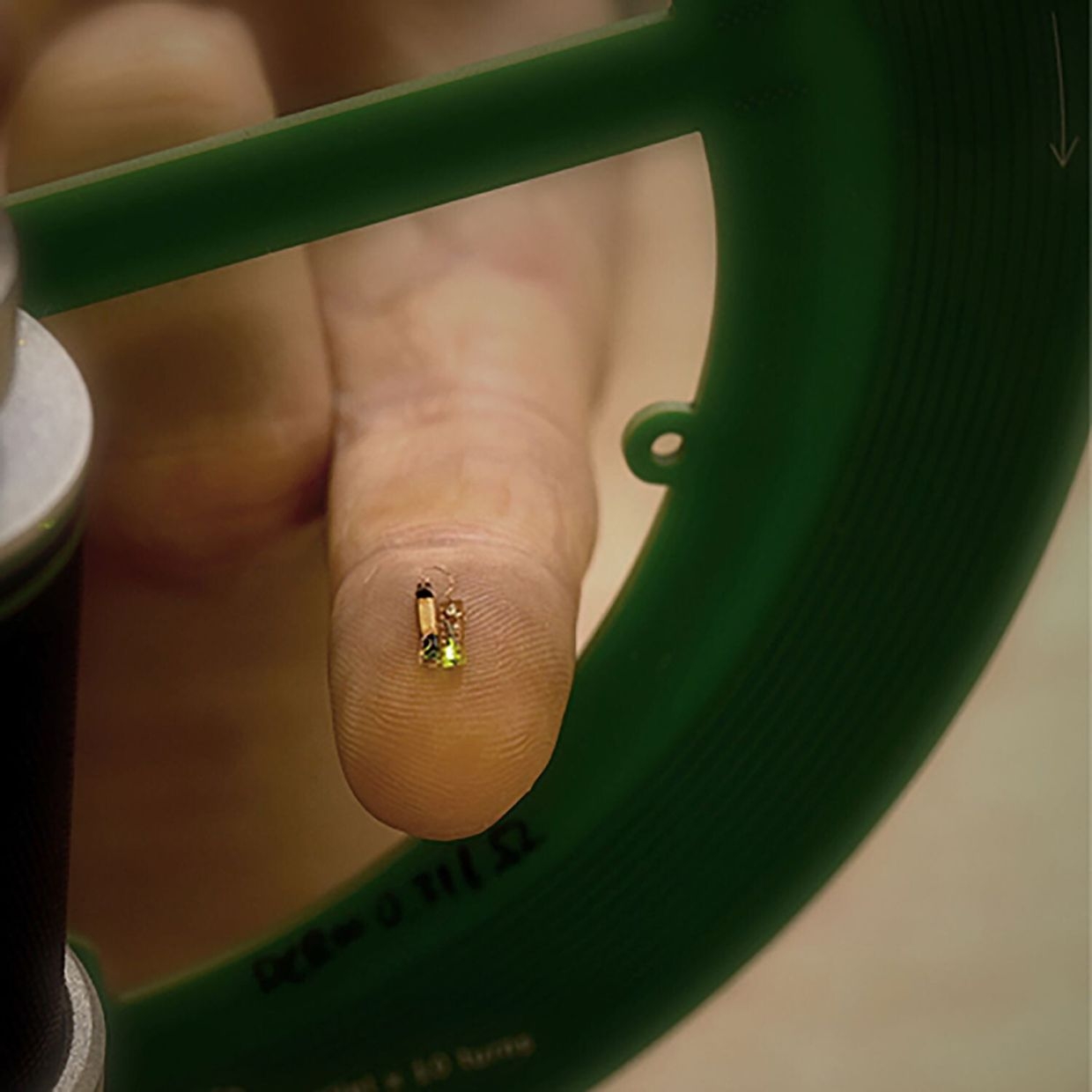 Soon miniature chips in the brain could treat degenerative diseases