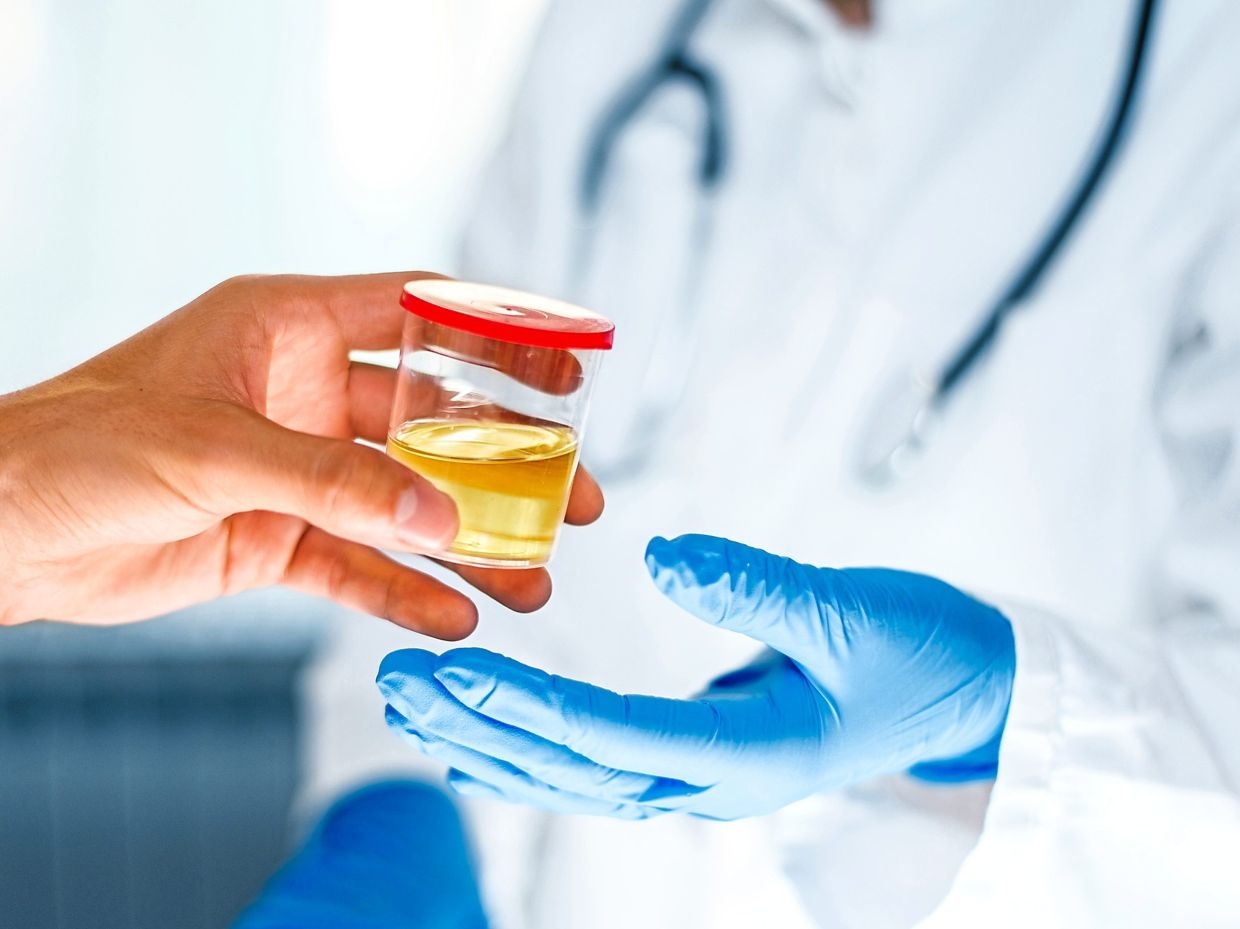 Urine drug testing remains standard for vocational drivers, says AOEMM