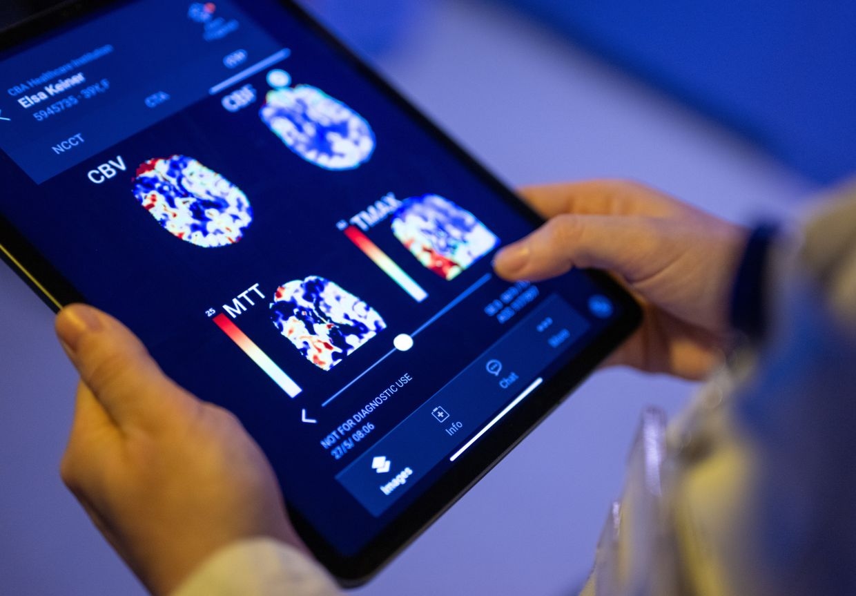 AI-dependent doctors risk failing to detect colon cancer
