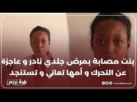 بنت مصابة بمرض جلدي نادر و عاجزة عن التحرك و أمها تعاني و تستنجد