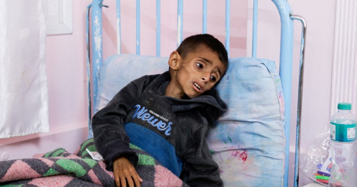 بالصور.. حصار إسرائيل يدفع غزة نحو أزمة جوع غير مسبوقة وأوضاع إنسانية كارثية