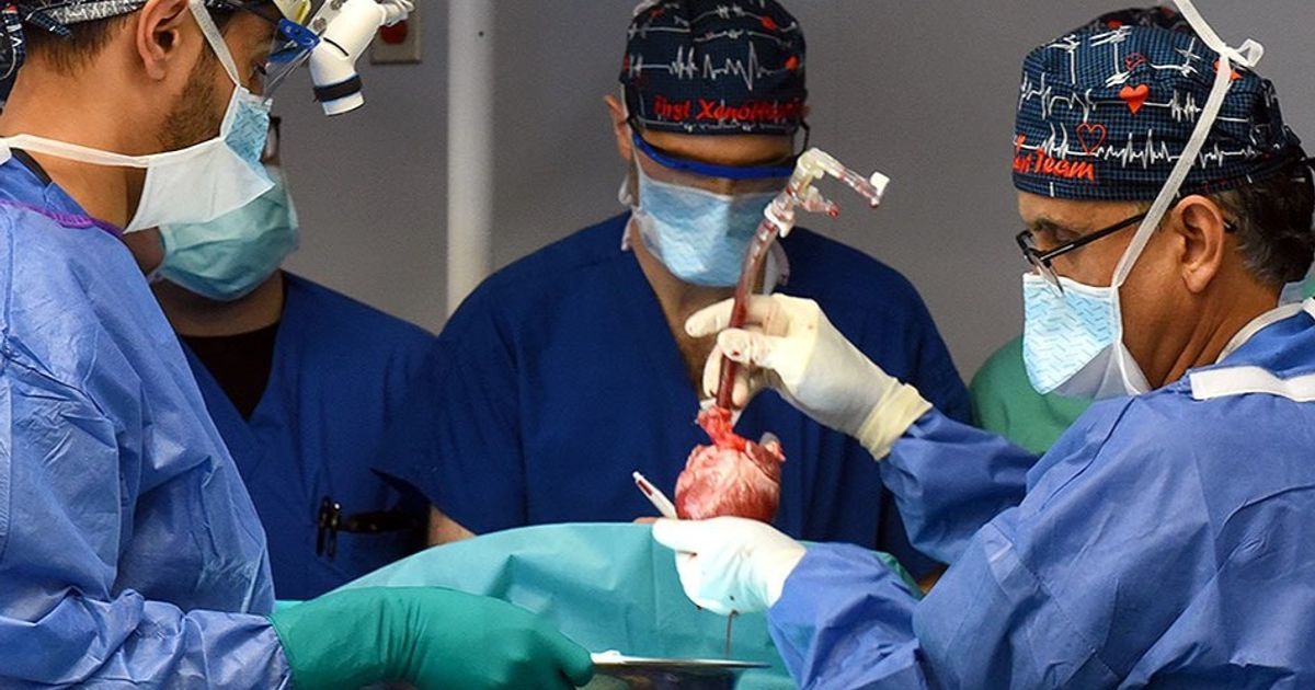 نهج مبتكر في علاج سرطان الرئة بالإشعاع يقلل خطر إصابة القلب