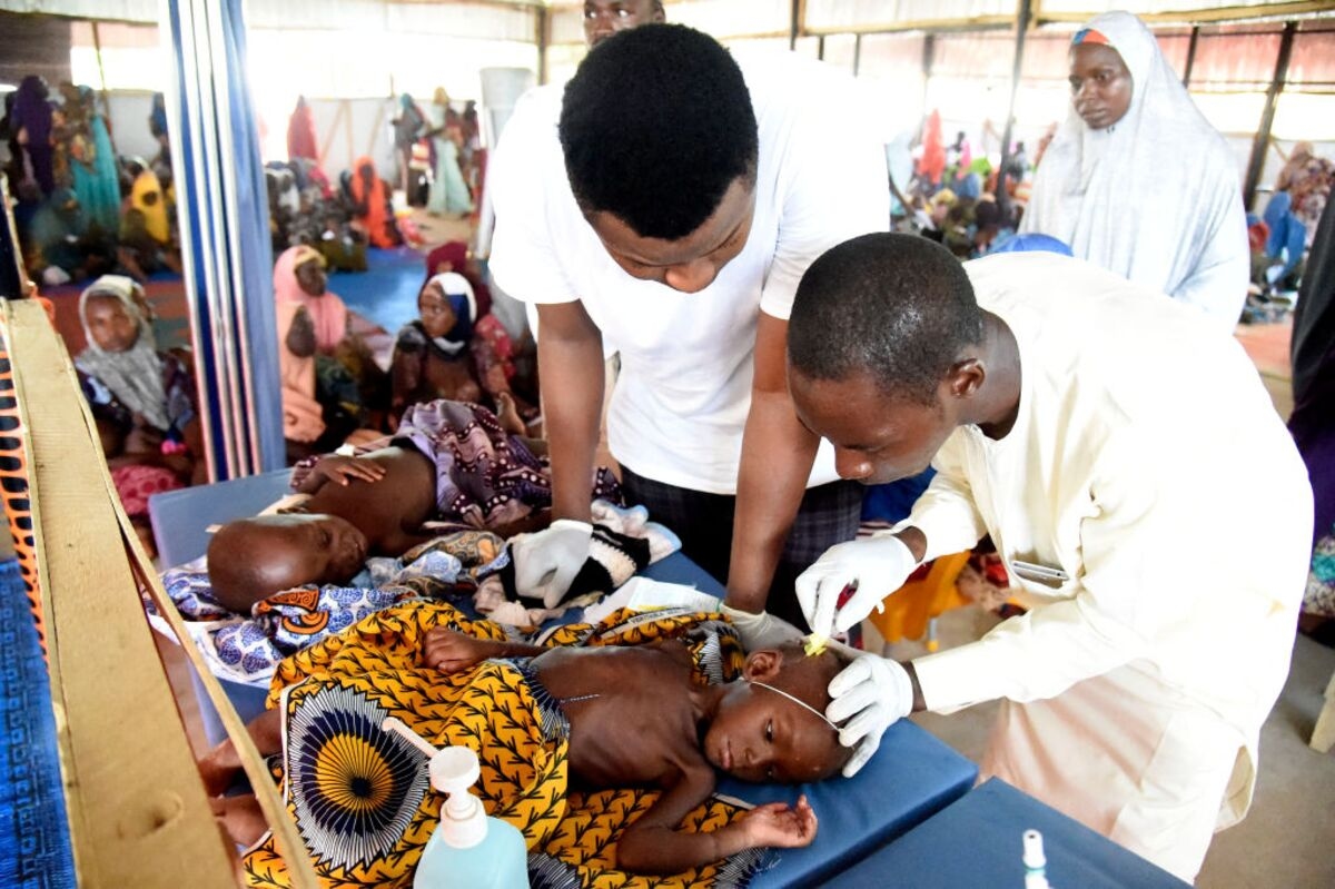 Deadly Child Malnutrition Surges in Nigeria as Aid Cuts Bite