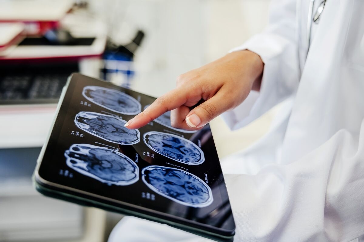 China Joins US in Brain Implant Race With Clinical Trial