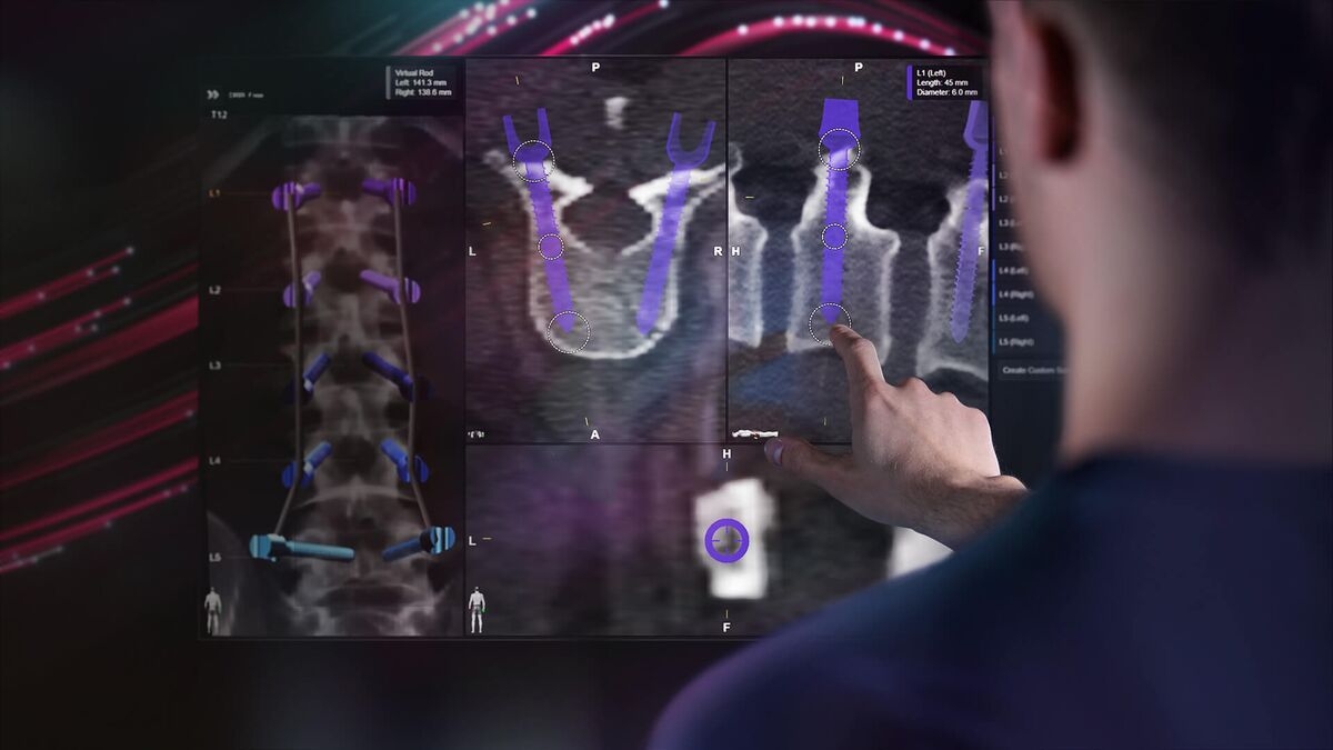 Medtech Brainlab, Holders Seek €400 Million in Frankfurt IPO