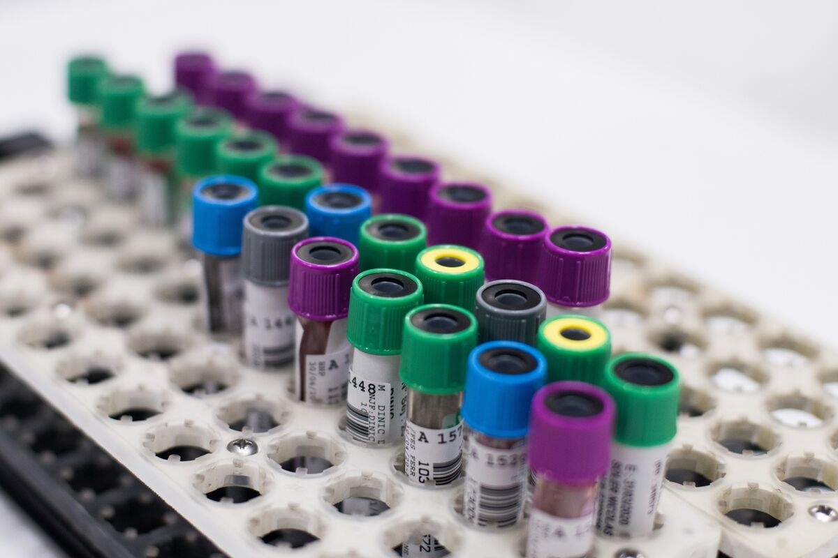 A Bitter Pill for Lab Firms as France Seeks to Cut Subsidies