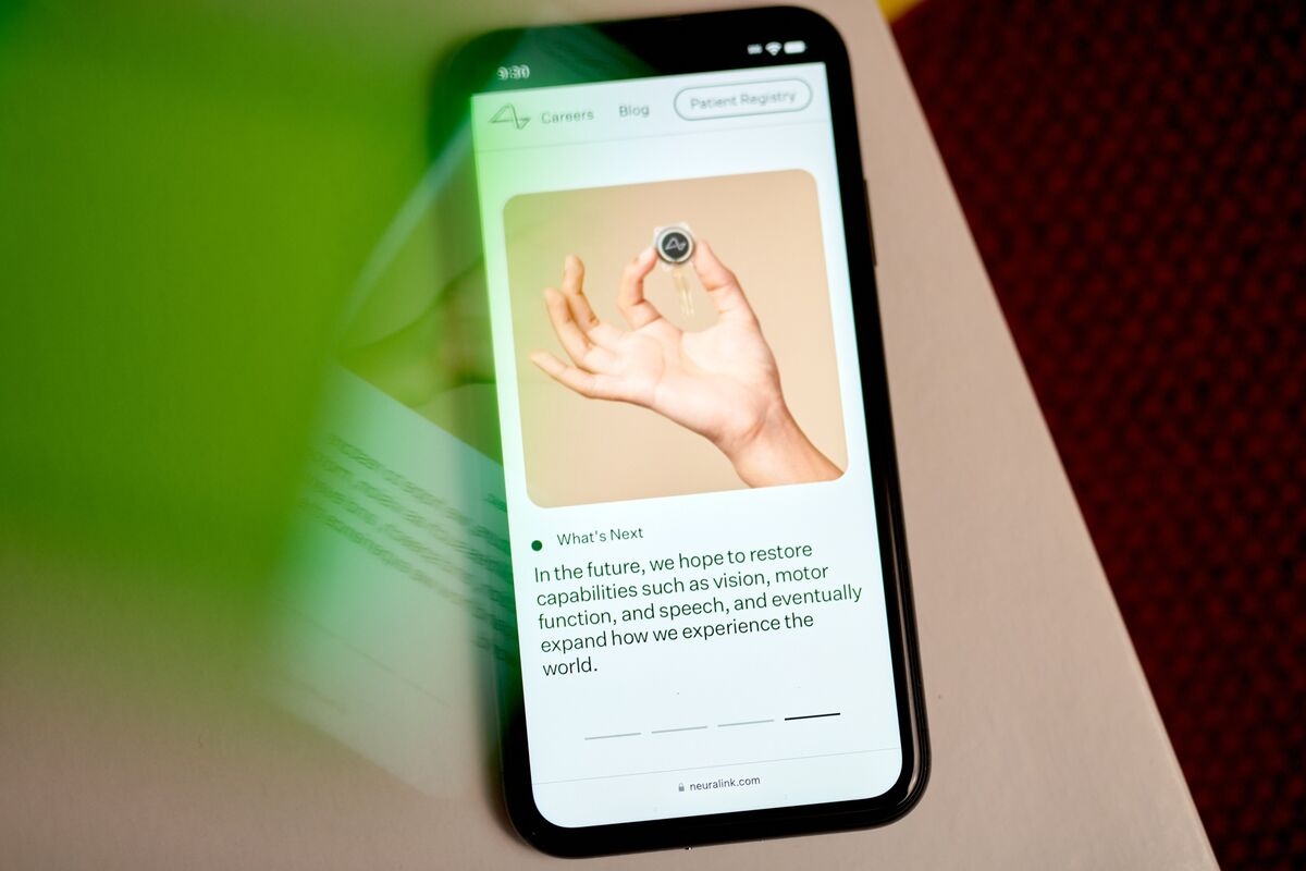 Neuralink Launches Clinical Trial in Britain to Test Brain Chip
