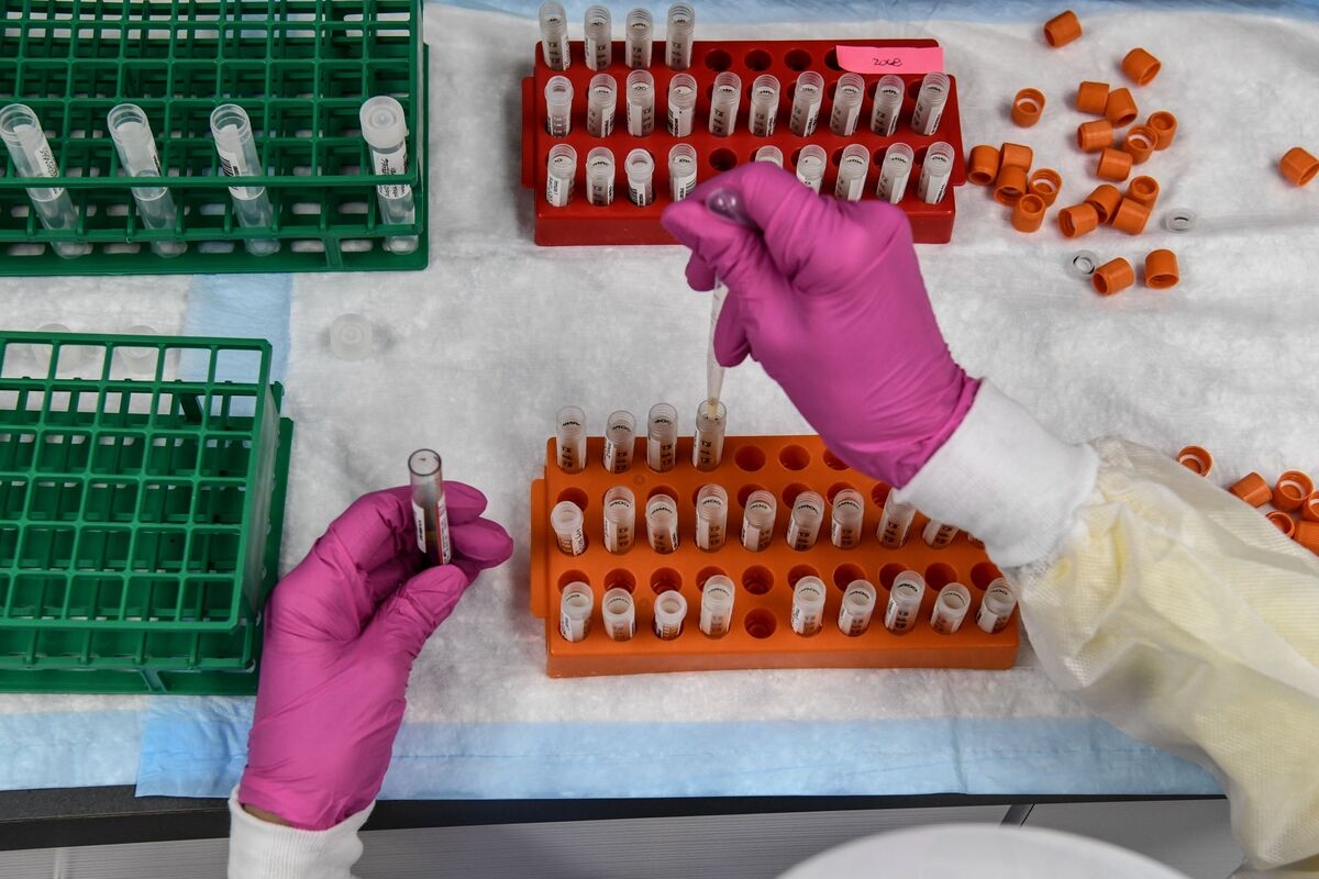 How Covid Can Break Blood Vessels and Clog Arteries