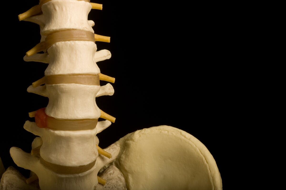 AI-Surgical Firm Carlsmed Seeks to Raise $107.2 Million in IPO