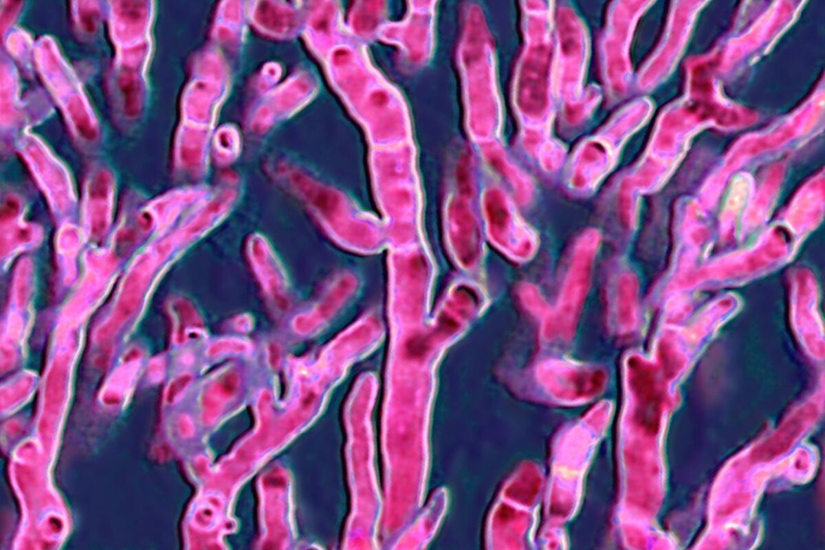 Deadly Fungi Are Here, and They're Spreading