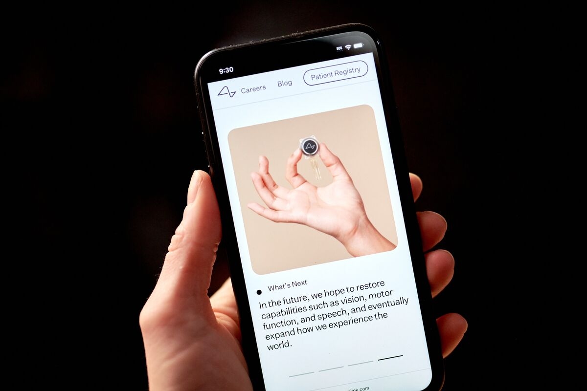 The Brain Implant World Buzzes as Billionaires Rush In