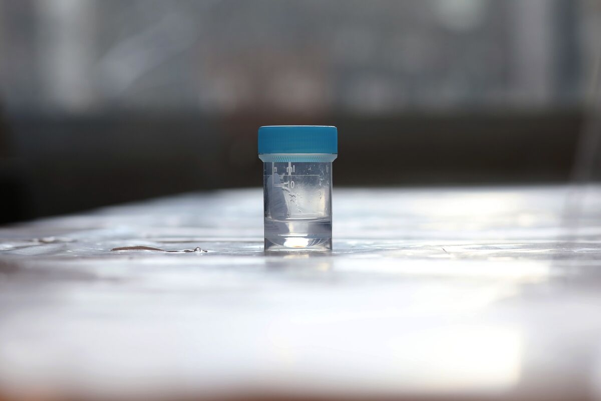 Is a $140 Gut Microbiome Test Worth the Money?