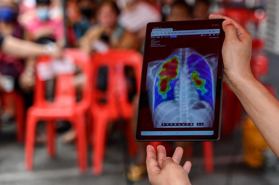 Smokers, elderly men most susceptible to TB, Penang data shows