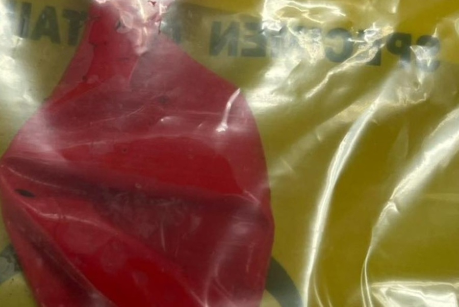 Boy nearly chokes to death on birthday balloon