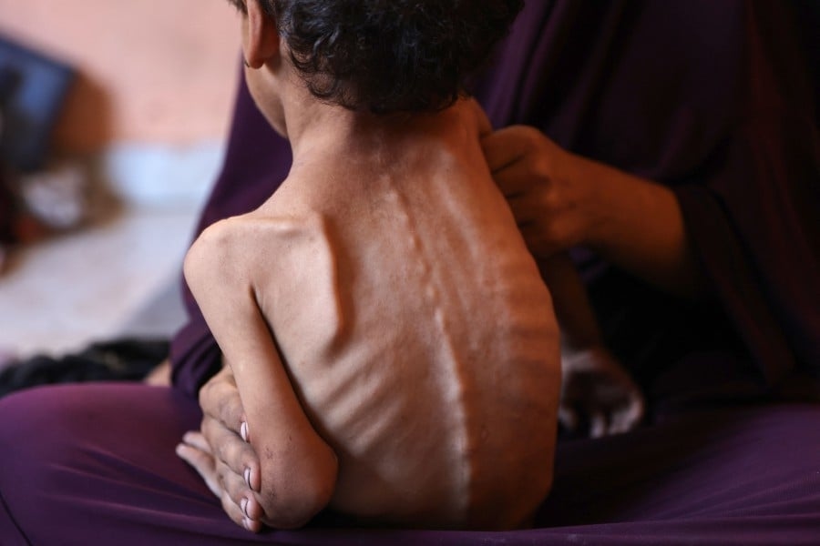 Gaza facing deadly hunger crisis, warns WHO