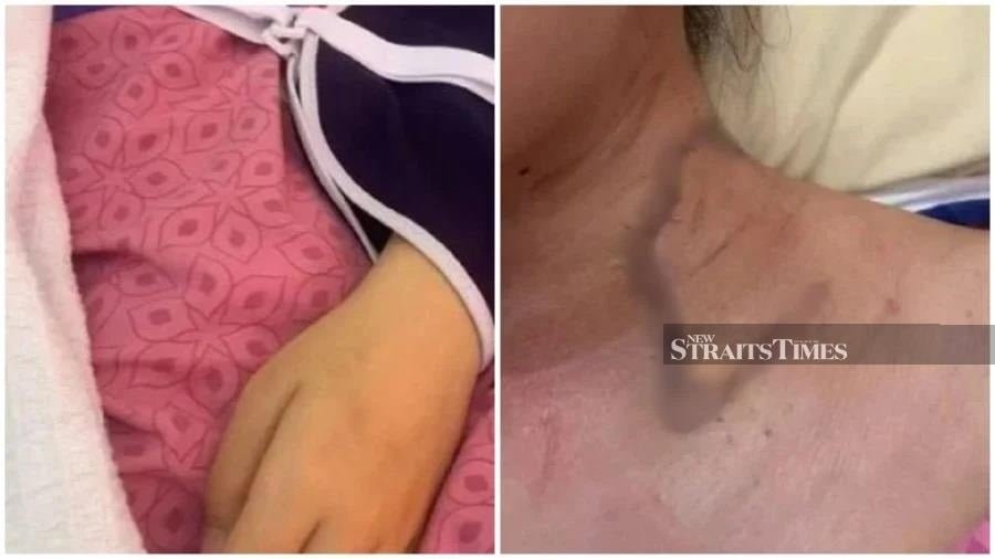 Stabbed foreign university student mulls action against university