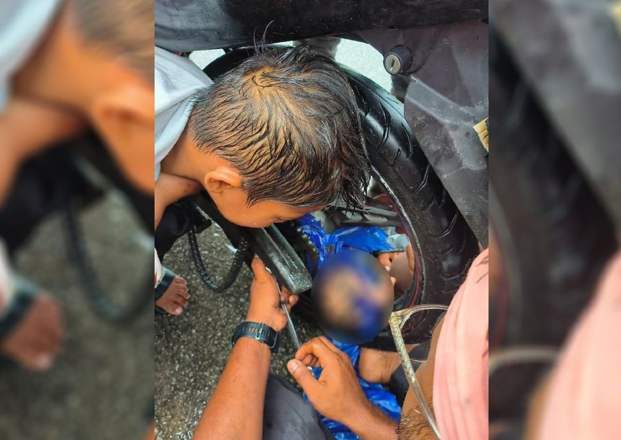 Teen's hand caught in motorcycle spokes during road crash