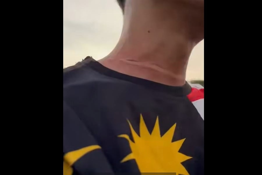 Motorcyclist sustains neck injury from stray kite string [WATCH]