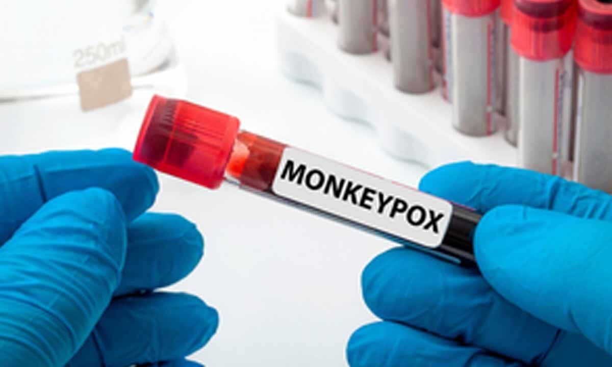 Uganda sees nearly 70 pc drop in mpox cases over four weeks