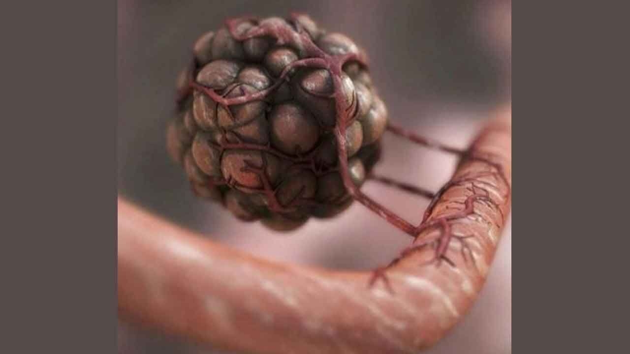 Researchers find genetic fingerprints to predict efficacy of immunotherapy