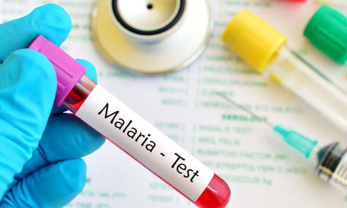 Blood tests to be held in malaria prone areas