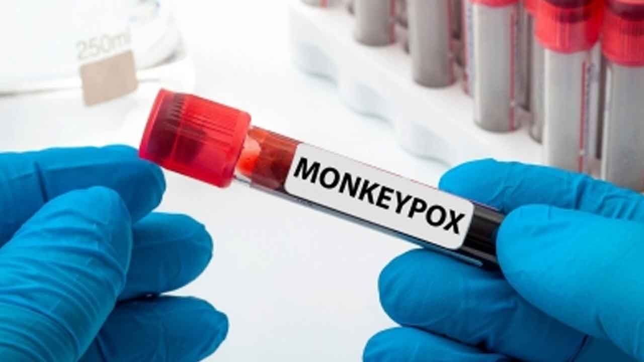 mpox virus circulating in West Africa long before 2022 global outbreak: Study