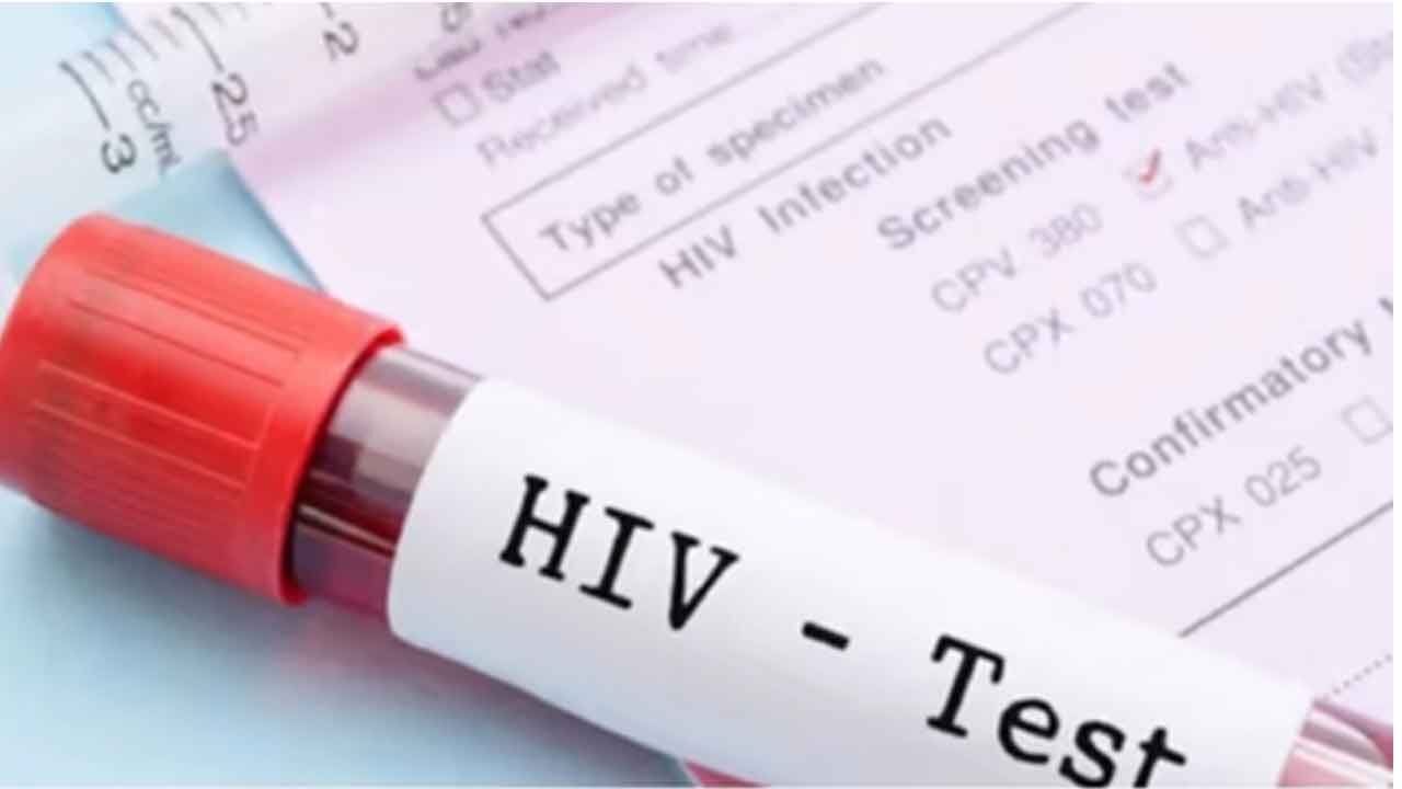Singapore reports 151 new HIV cases in 2024, over half diagnosed at late stage