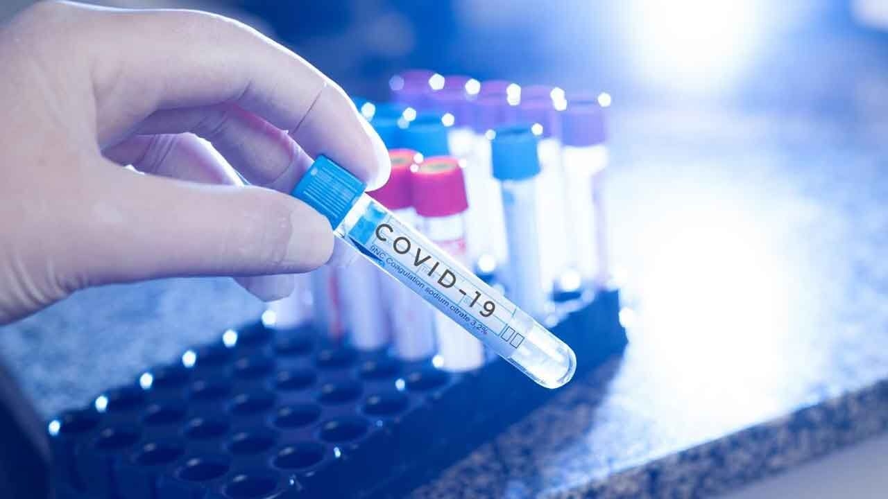 Govt directs authorities to stock up Covid-19 testing kits
