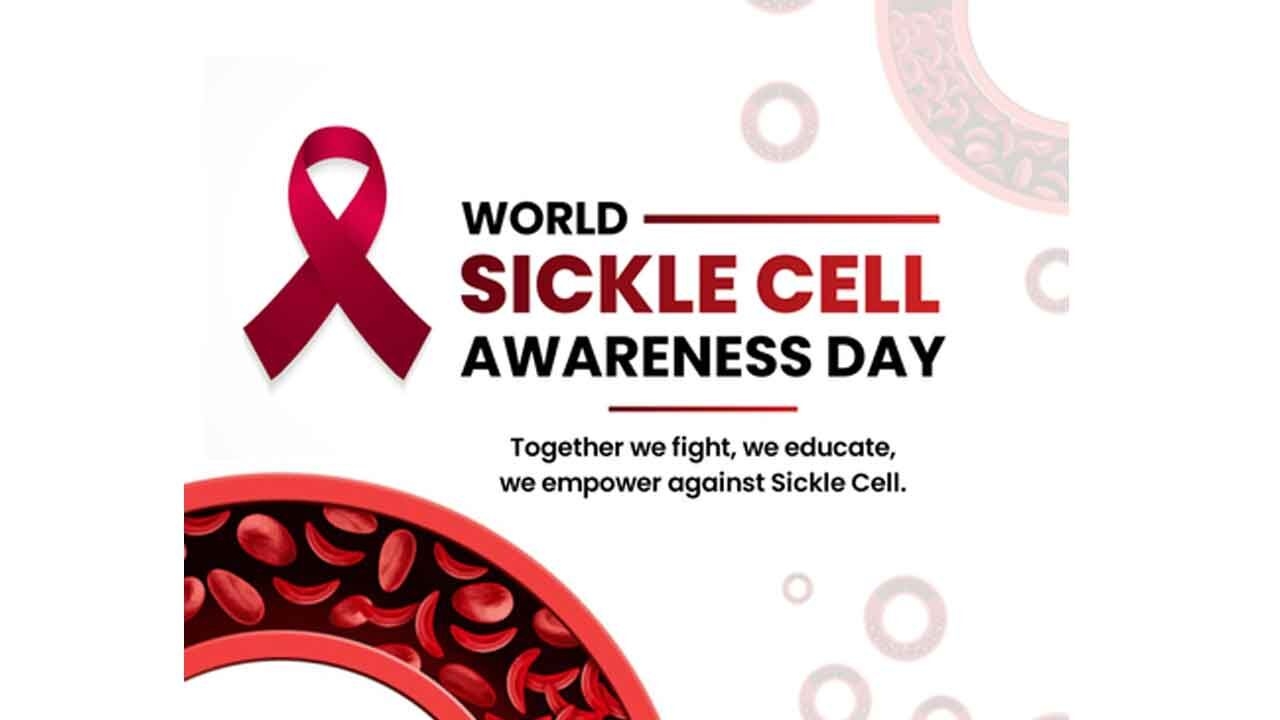 5.72 crore people screened for Sickle Cell Disease: Centre