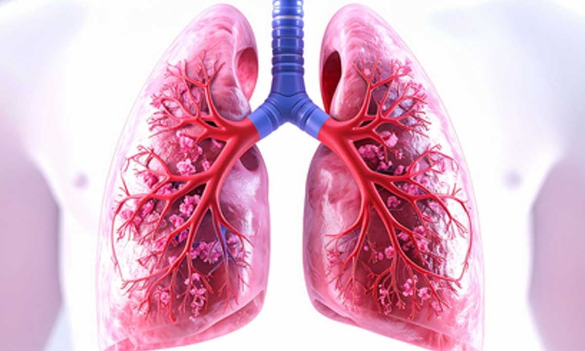 Lung TB: Higher dose of rifampicin safe, can boost recurrence-free survival, says ICMR study