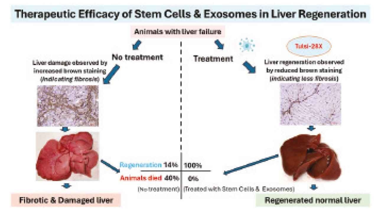 Hyderabad: City startup achieves global first in regenerative medicine for liver failure
