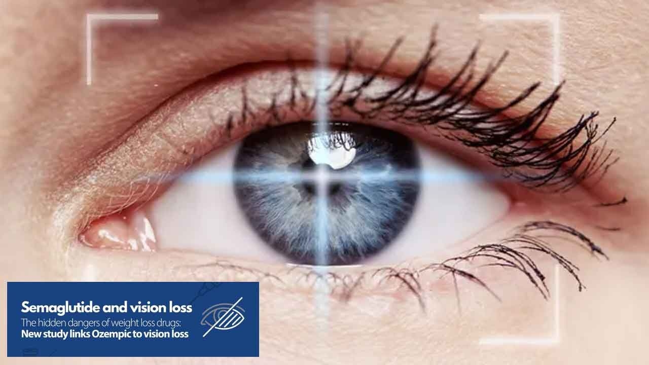 Weight-loss drugs can lead to serious eye conditions